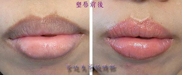 唇3.jpg 唇3.jpg