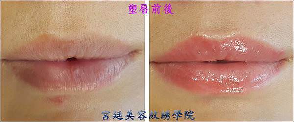 唇2.jpg 唇2.jpg