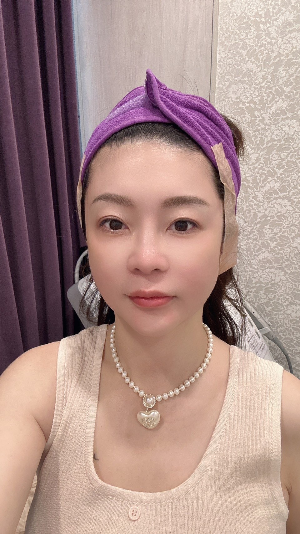 【台中Z音波】佳思優整形外科美學診所│法令木偶紋消去法,中下臉提拉更快速有感 - 第18張圖 【台中Z音波】佳思優整形外科美學診所│法令木偶紋消去法,中下臉提拉更快速有感