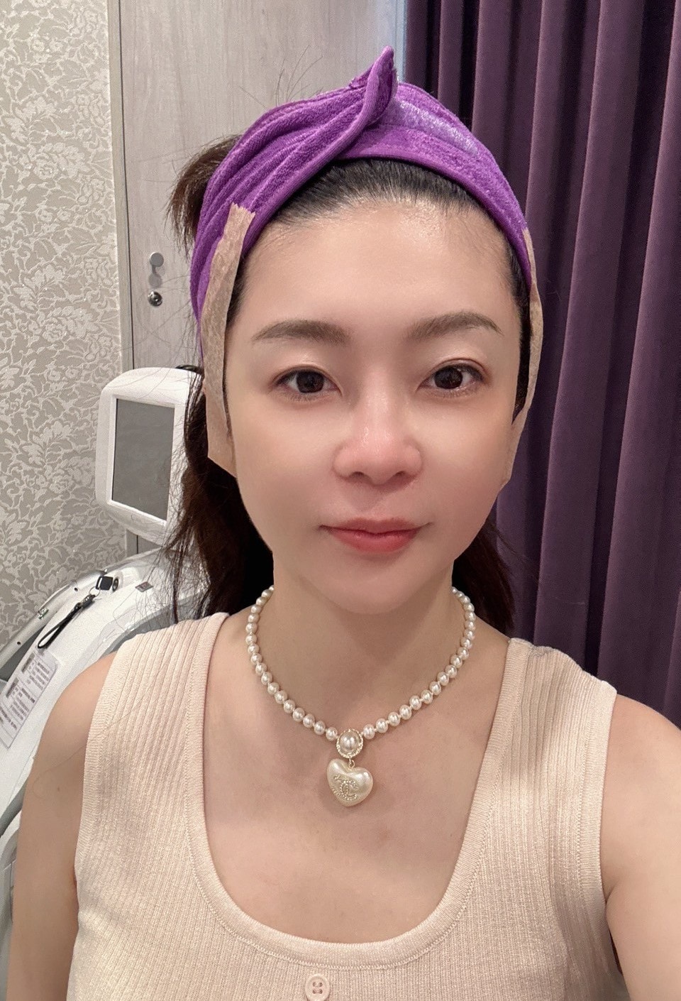 【台中Z音波】佳思優整形外科美學診所│法令木偶紋消去法,中下臉提拉更快速有感 - 第16張圖 【台中Z音波】佳思優整形外科美學診所│法令木偶紋消去法,中下臉提拉更快速有感